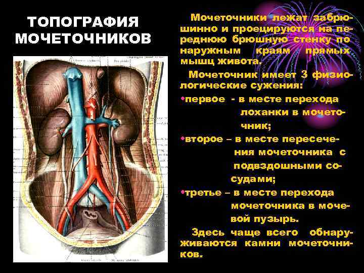 Мочеточник слева